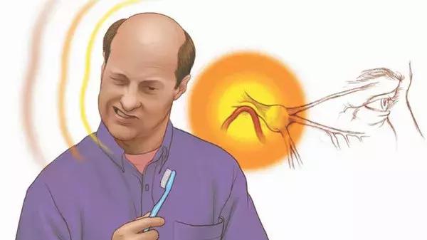 「针知识」三叉神经疼痛难忍，试试这个针灸疗法