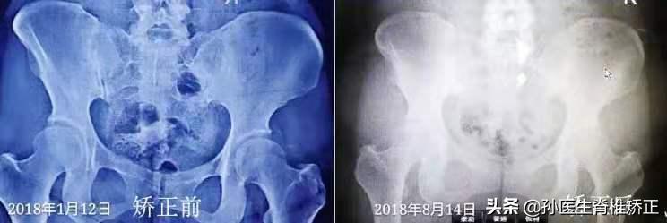 脊骨神经医学(美式脊椎矫正)精品课程