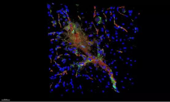 《自然》论文：肠道微生物也能影响肌肉萎缩
