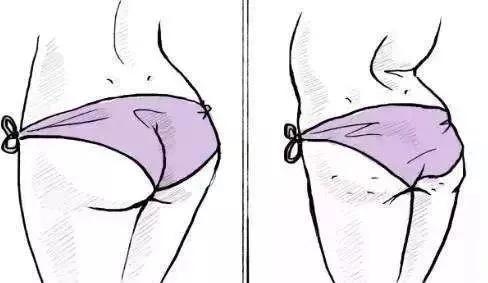 什么样的臀部是形状完美的,女性的臀部类型有哪些