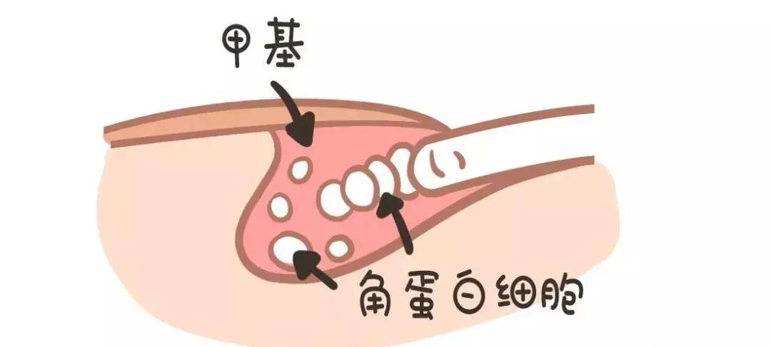 宝宝指甲月牙少有白点怎么回事,宝宝指甲出现空甲现象怎么办