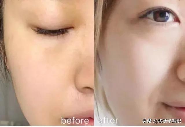 冬天脸干，连皱纹都出来了？日本女博士教你一招，抹几下白白嫩嫩