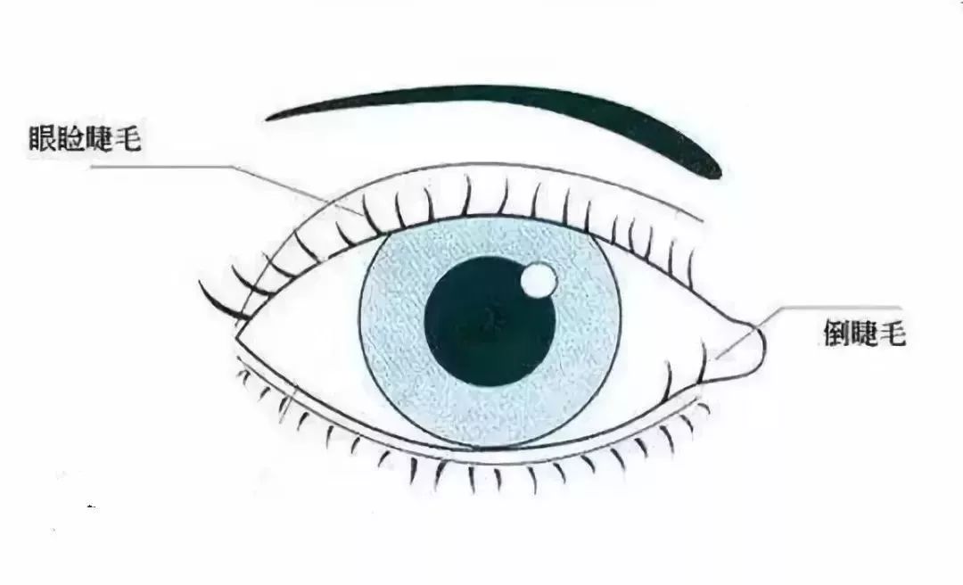 剪短眼睫毛能让眼睫毛长得更长吗,眼睫毛剪短了还能长出来吗