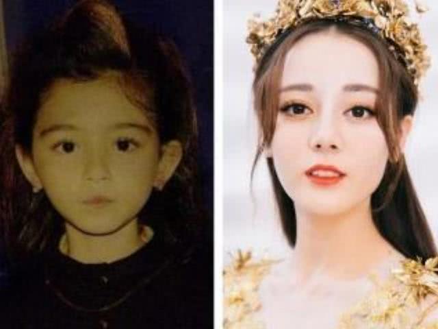 天生特别好看的孩子基因缺陷,长得高的孩子有哪些特征