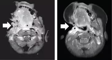国外最新的抗癌药叫什么名字,美国十大抗癌药物排名