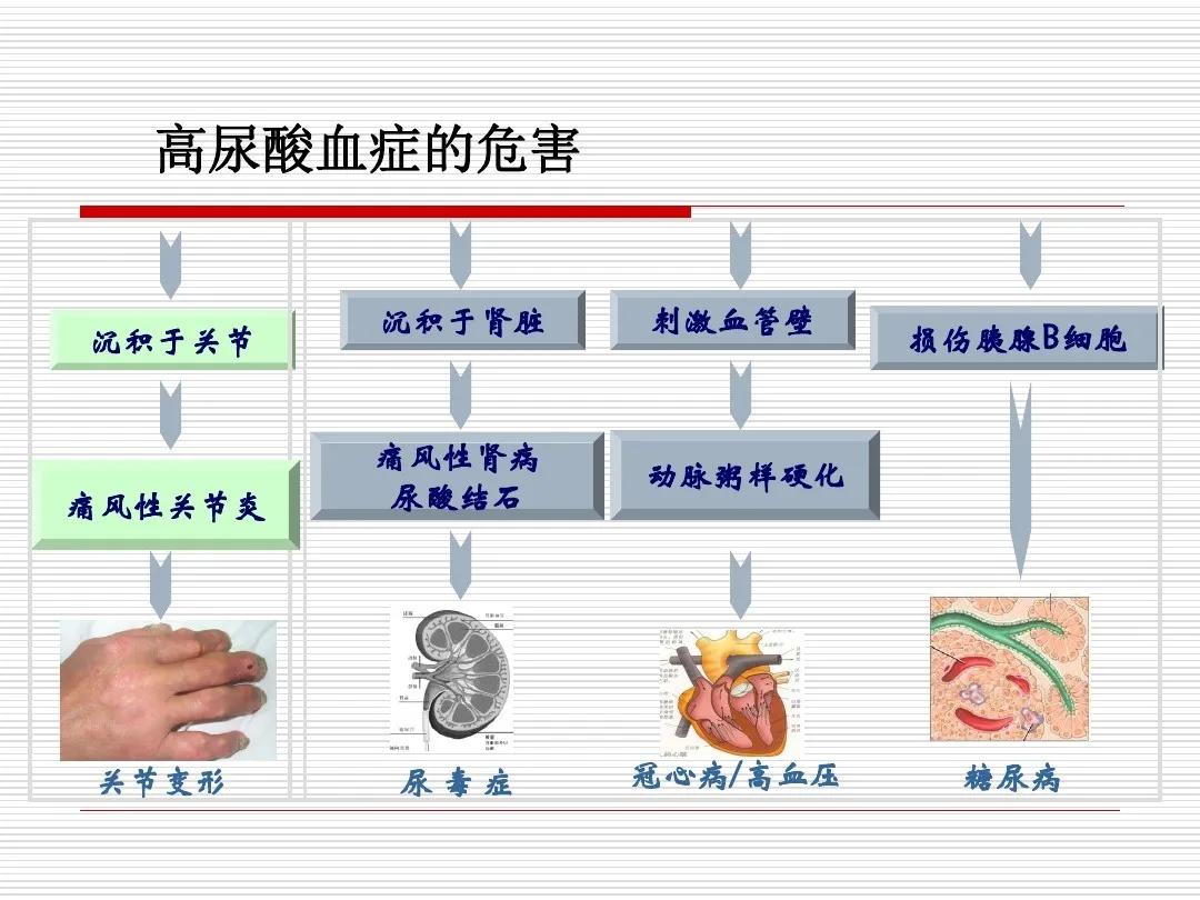 700尿酸属于什么等级,尿酸700多怎么调理