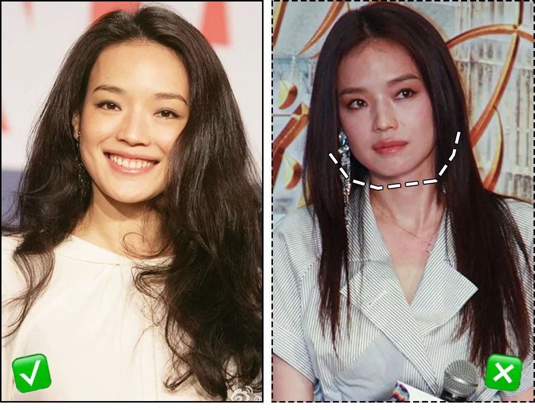 方脸怎么办教你一招就够了,方脸侧脸很丑怎么办