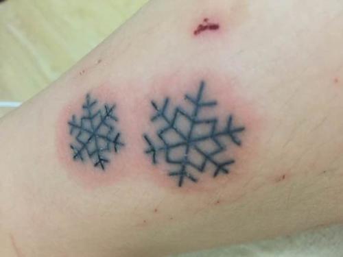 小块的白癜风能用纹身遮盖吗,白癜风用纹身能盖住吗