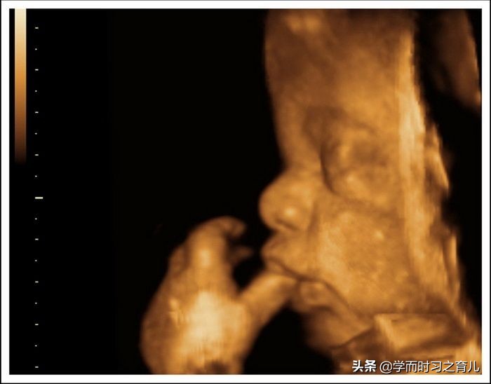 做四维检查胎儿不翻身怎么办,四维彩超常见问题分析
