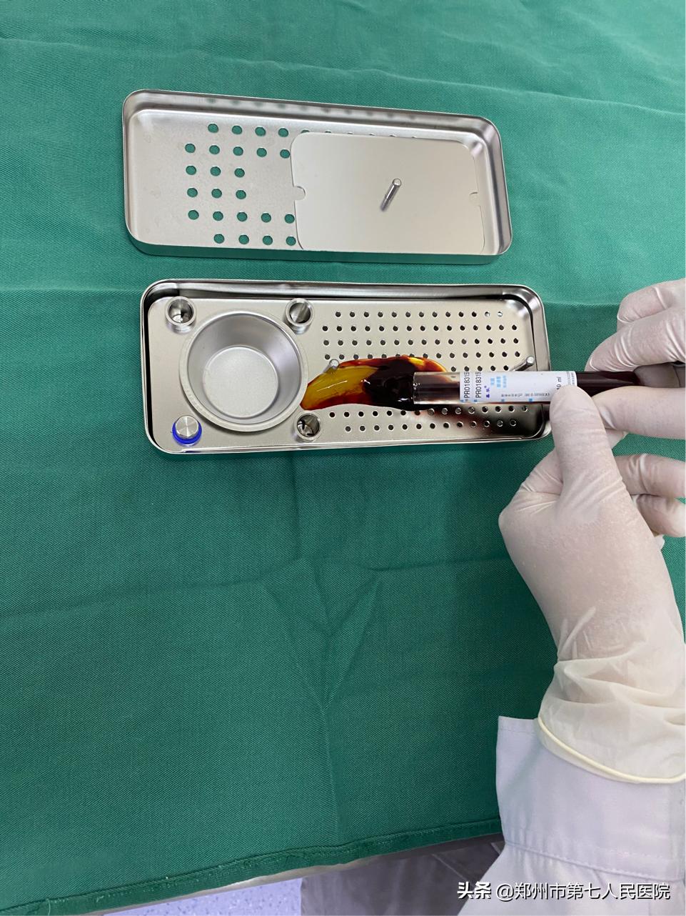 看牙也抽血？什么是CGF？