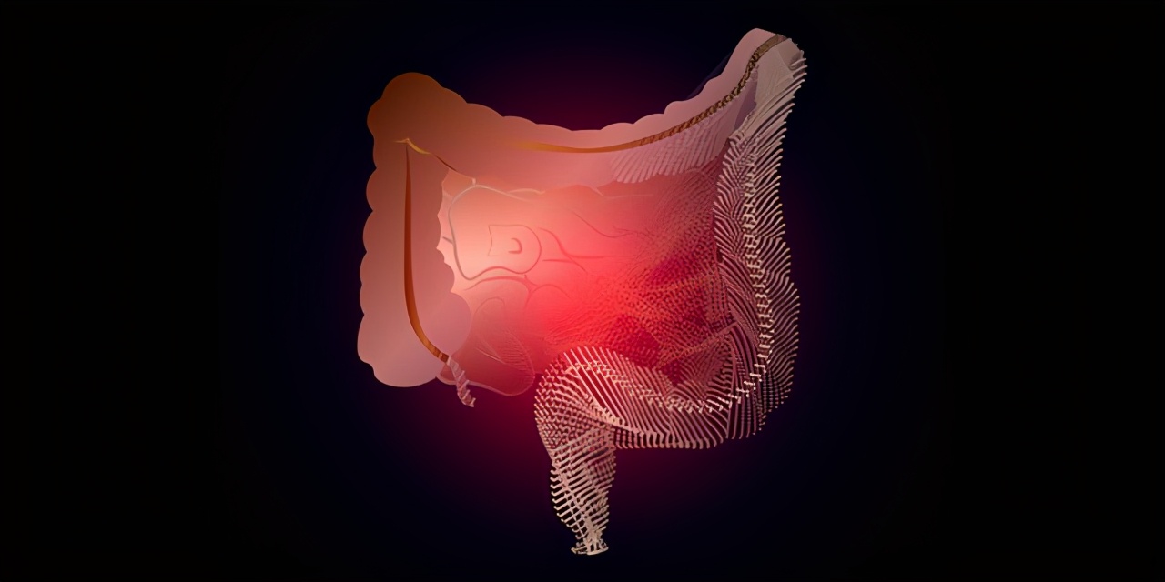JAMA巨献:说透克罗恩病