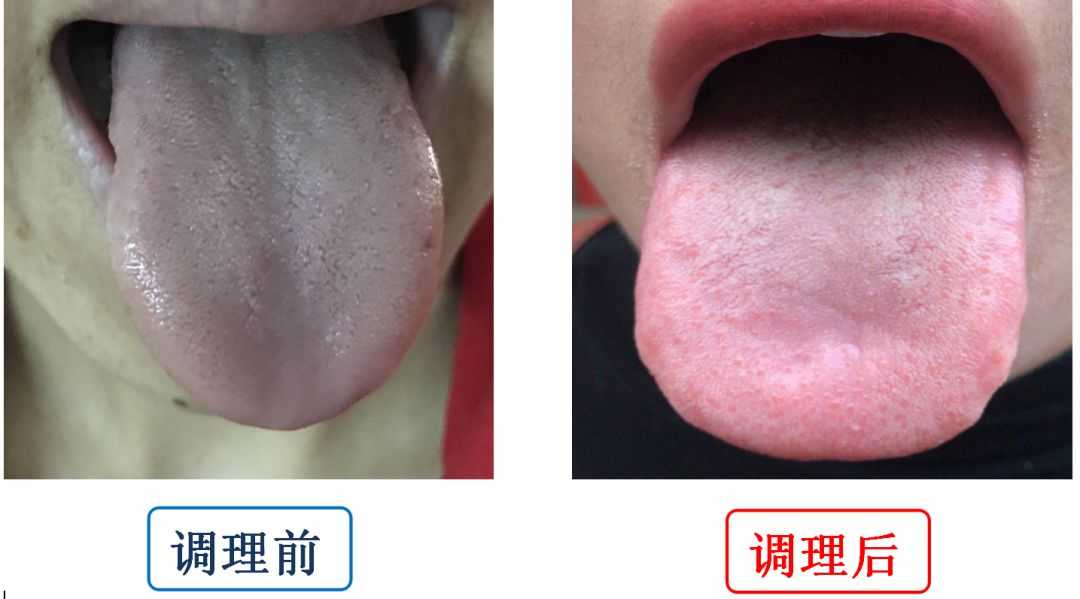 痛经时可以用热水袋热敷腹部么,一痛经就头疼怎么办