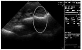 母猪兽用b超怎么看图谱,兽用b超机如何看母猪怀孕