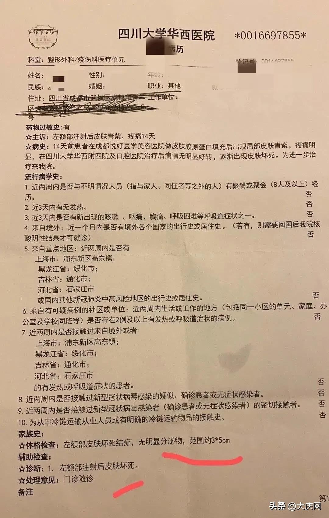 花4万块丰额头,两针打下去差点毁容