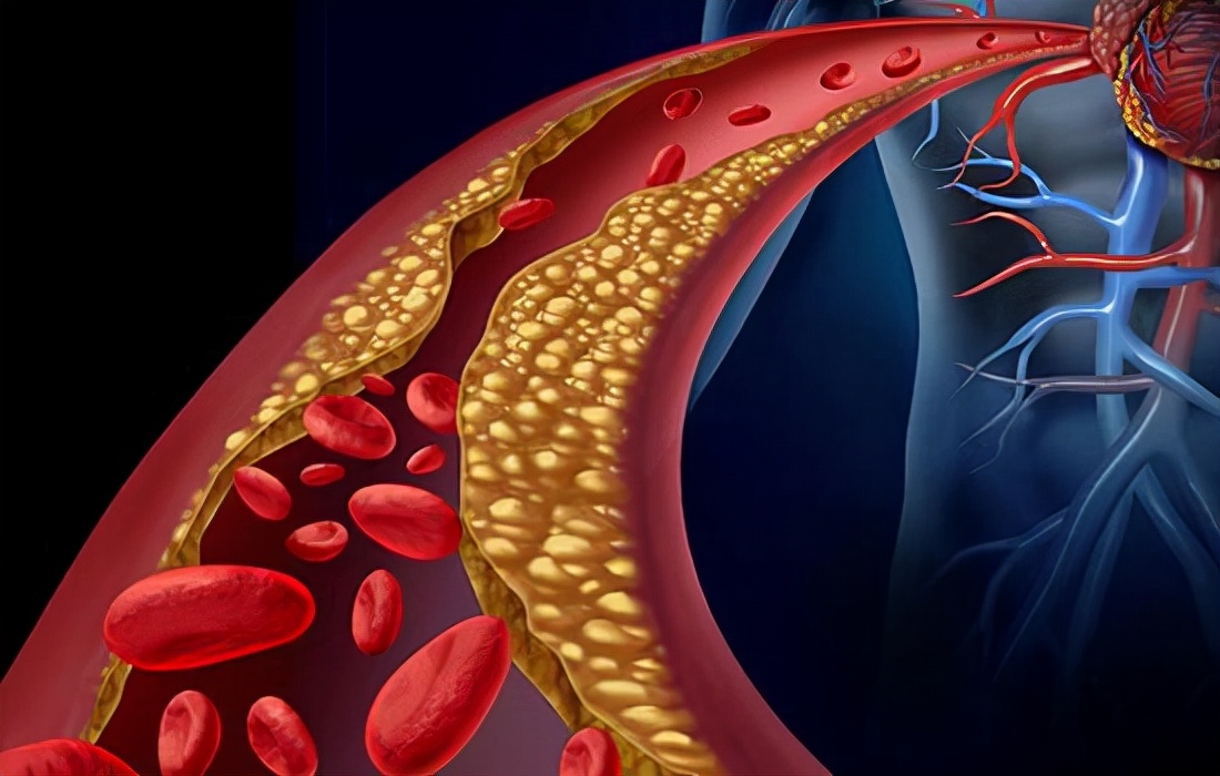 阿司匹林滥用案例,阿司匹林的错误吃法