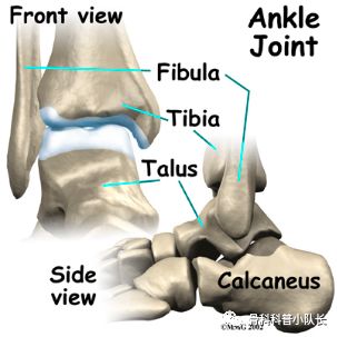 刚崴脚是要冷敷还是热敷,崴脚后24小时内是热敷还是冷敷