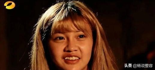 隆鼻失败修复的几点建议,隆鼻失败医生会马上为患者修复吗