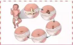 新生儿脐带很脆弱：出血、流水、发炎、发红、不脱落如何护理？