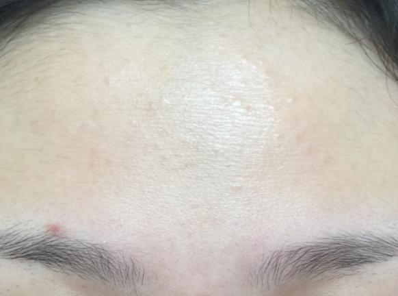 实战5年分享去闭口经验,含有大量干货!请查收