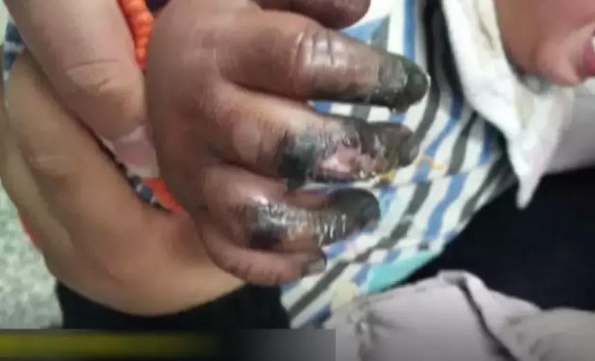 电动车充电口会有火花影响电瓶吗,电动车充电时会不会电人