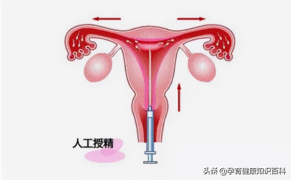 不明原因不孕怎么解决,不孕不育的十大前兆