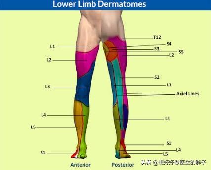 有些患者膝盖疼痛是由腰椎间盘突出压迫神经导致的,千万别忽视