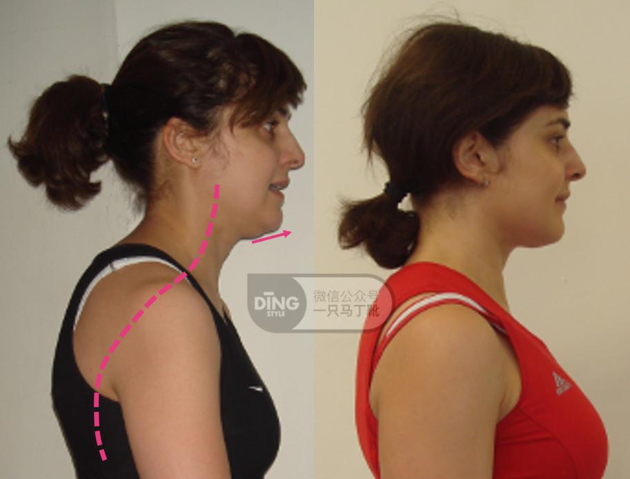 有效改善体态,提升气质减肥瘦全身方法