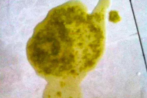 新手爸妈稳住！手把手教你看懂千姿百态大便便（超全观察指南）