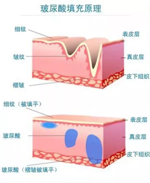 明明没动刀，为什么脸还是越来越精致？