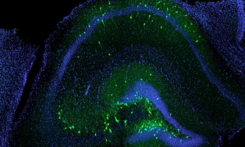 研究表明大脑具有自我修复,脑细胞再生技术研究现状