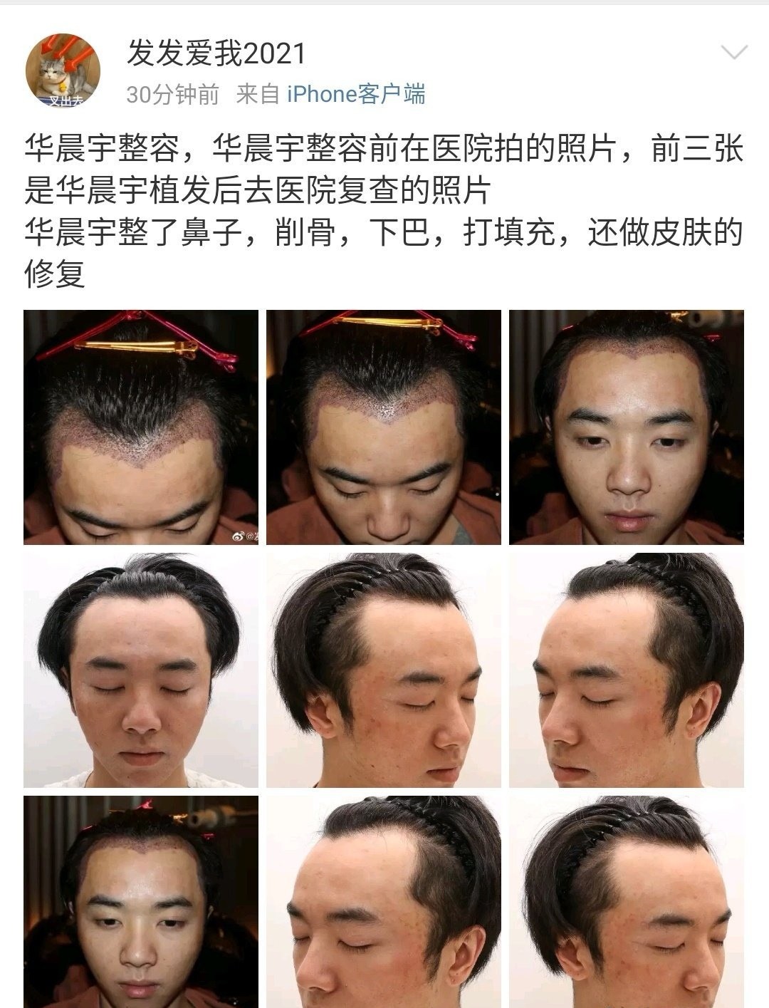 华晨宇又塌房？整容照片曝光，网友：就因为没续约？