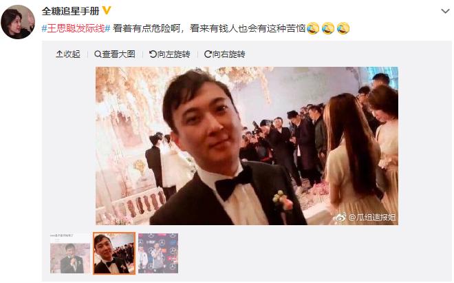 脱发和头发长有关系,脱发导致发际线一直往后拖