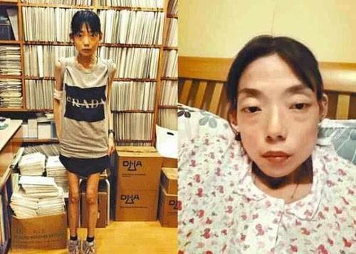 被豪门抛弃：昔日的22岁嫩模为取悦丈夫吃*肥药减**竟瘦成“纸片人”