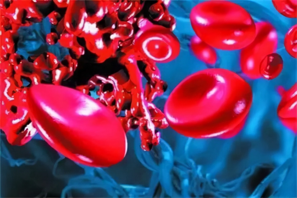 mds患者皮肤感染是怎么回事,mds患者如何补身体更好