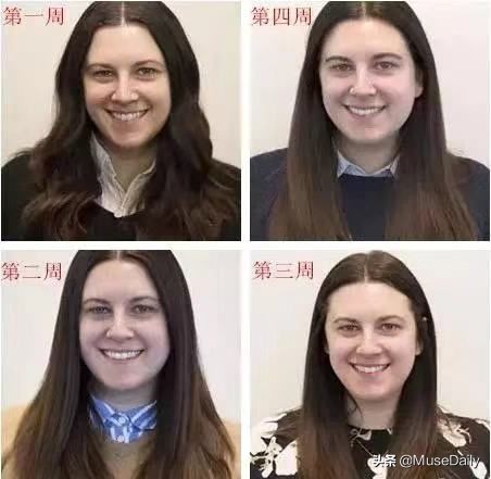 不洗脸皮肤会更好真的假的,连续一个月不洗脸皮肤会变好