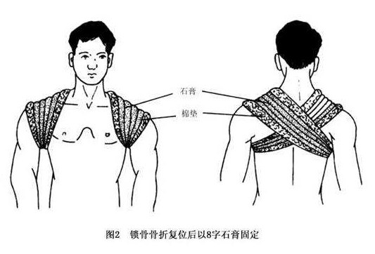 有多少脊椎病,是按出来的?