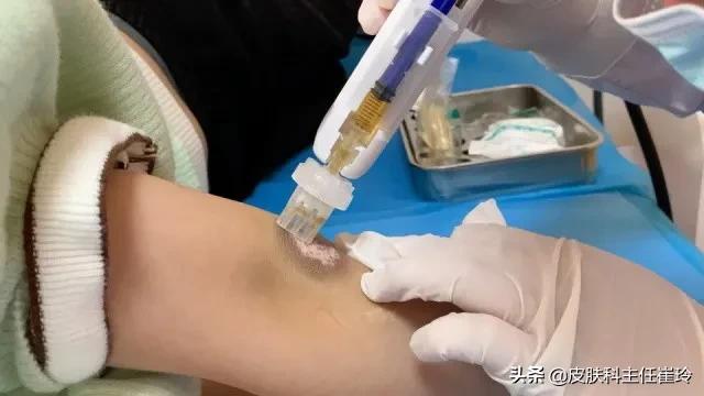 天津中都白癜风医院评价,中都白癜风医院天津