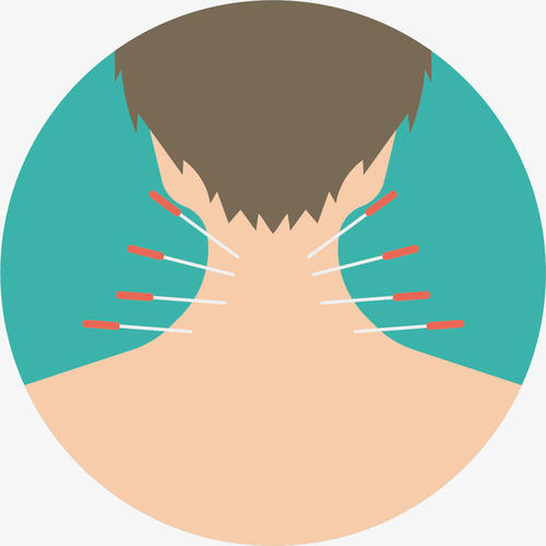 针灸减肥有没有什么副作用啊,关于针灸减肥有谁知道