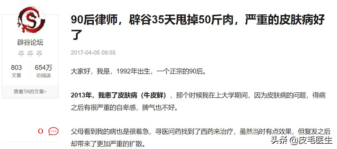 喝中药治疗荨麻疹反而严重了,防风能治荨麻疹吗