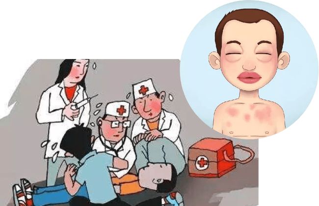 严重过敏会有其他并发症,严重过敏会致人死亡吗