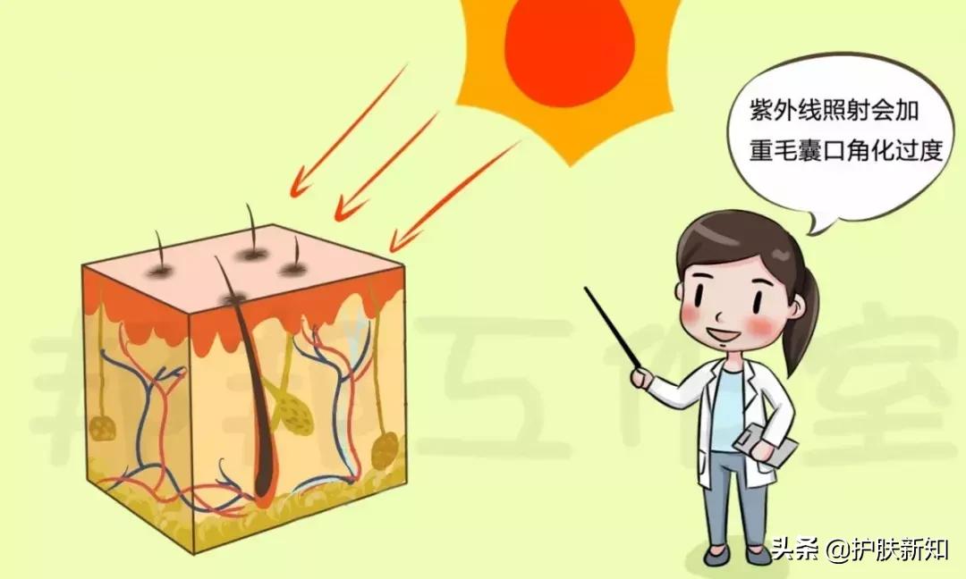 怎样彻底告别痘痘,怎样让痘痘快速消失皮肤变好