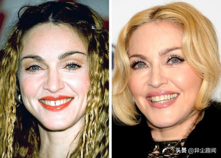 做牙齿美白的明星,明星的牙齿美白