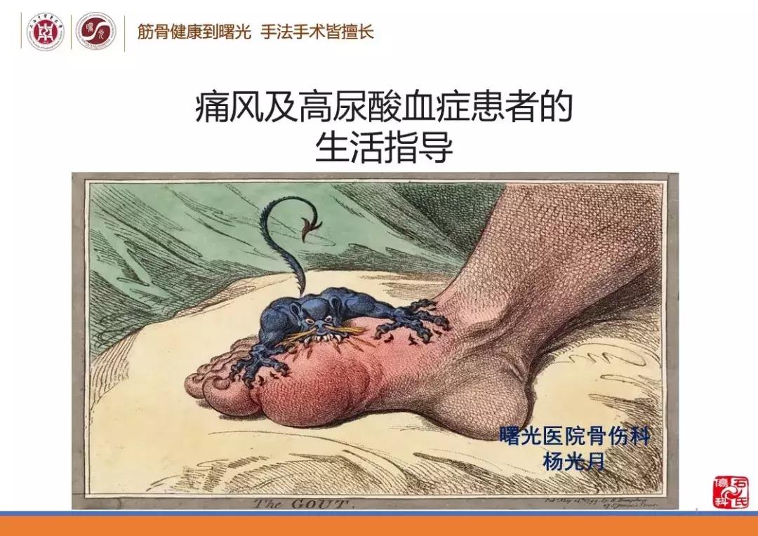痛风及高尿酸血症患者的生活指导