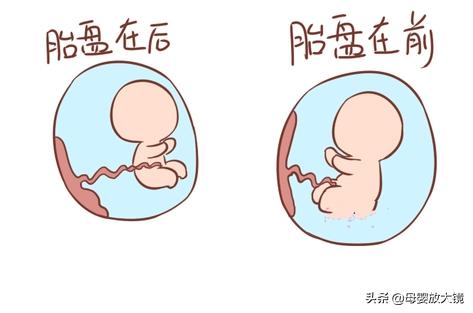 在孕早期孕妇应注意哪些问题,孕妈妈需警惕的产前几大症状