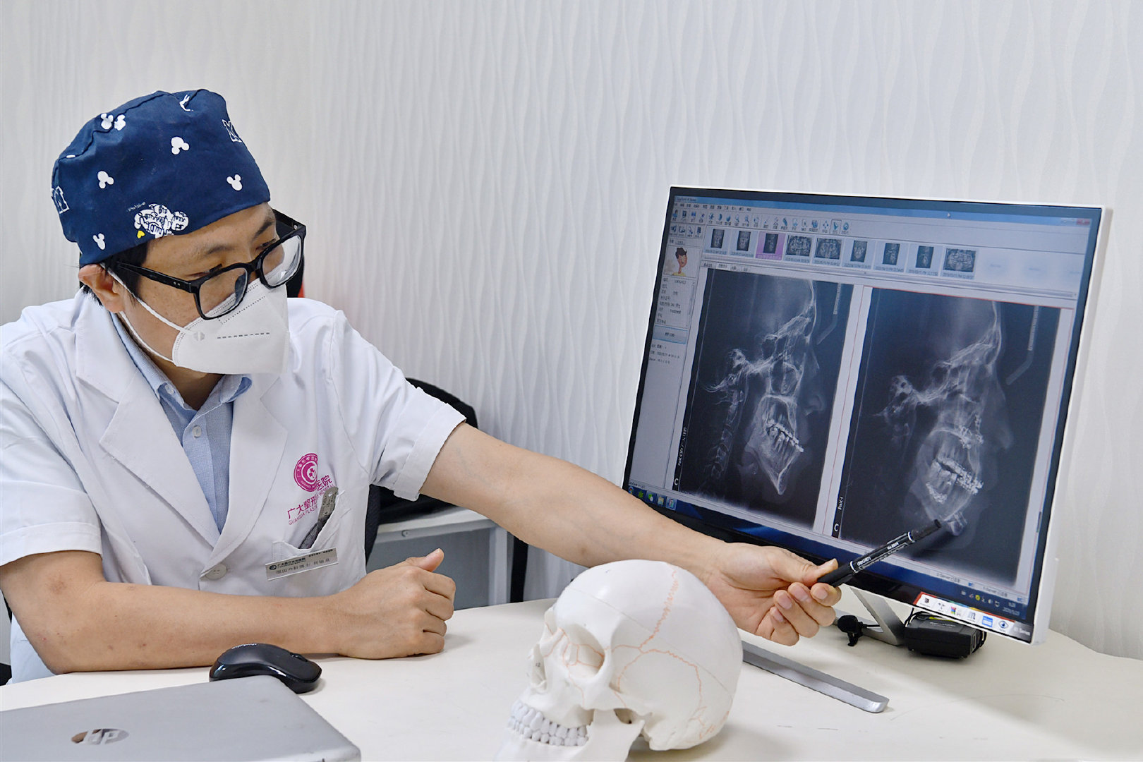 严重骨性地包天正畸效果,地包天矫正后又反颌怎么办