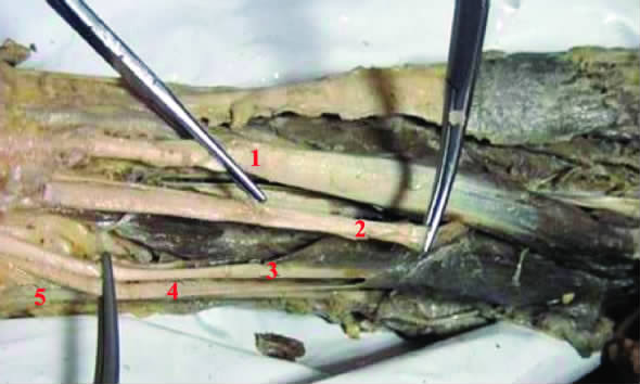 人体的变异,人体罕见变异现象排行榜