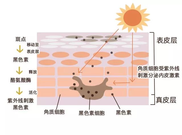 9个日常生活去黑眼圈小妙招,比较严重的黑眼圈怎么处理