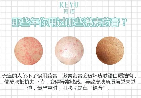 使用激素过度,过度使用药物危害