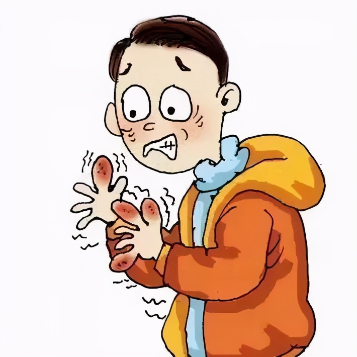 冻疮科普,冻疮从冷到长冻疮一般要多久