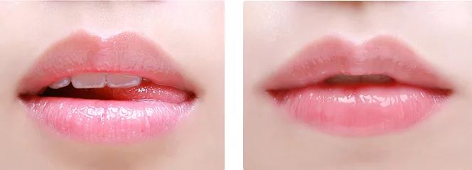 嘴唇不再干燥起皮温和润唇,秋冬唇干燥起皮